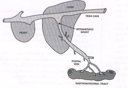 Liver Shunt